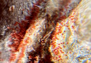 microscope image of mite larvae